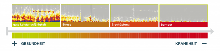 Herzratenvariabilität HRV Messung